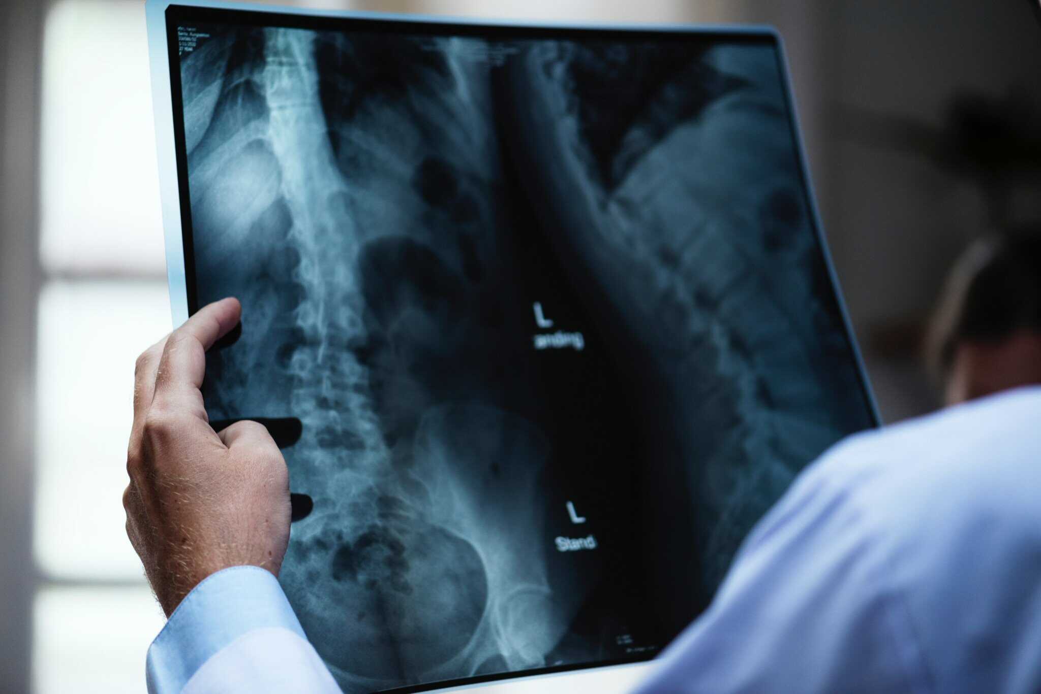 Car Accident Doctors - Robertson Injury Group